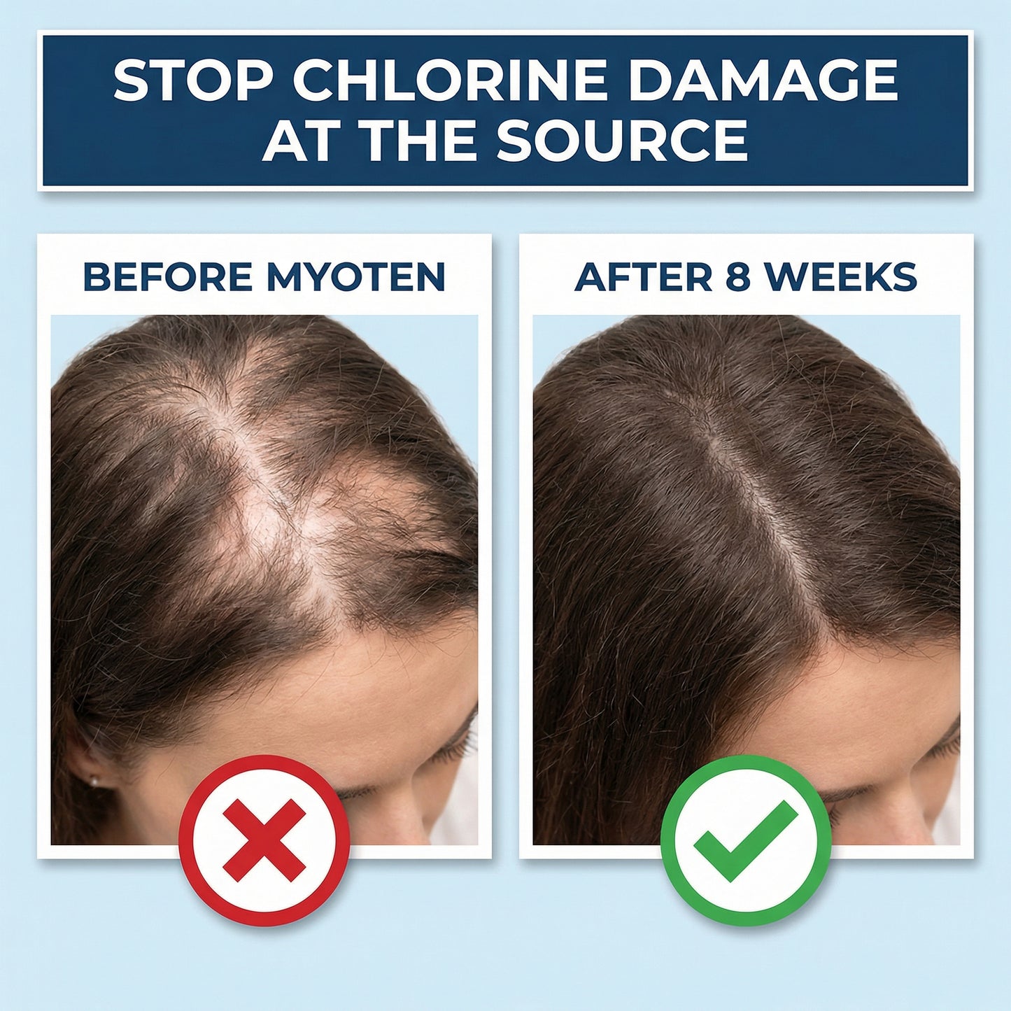 Myoten Filtered Showerhead + 1 FREE Filter (3-Month Kit)