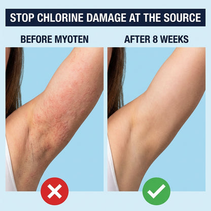 Myoten Filtered Showerhead + 1 FREE Filter (3-Month Kit)